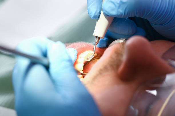Best Teeth Whitening  in Orange, OH