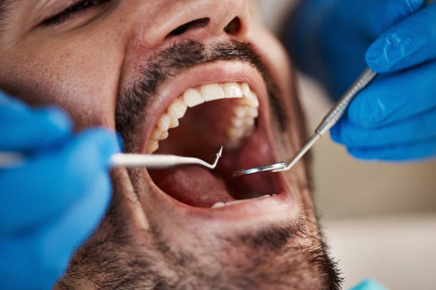 Best Cracked Tooth Emergency Dentist  in Orange, OH