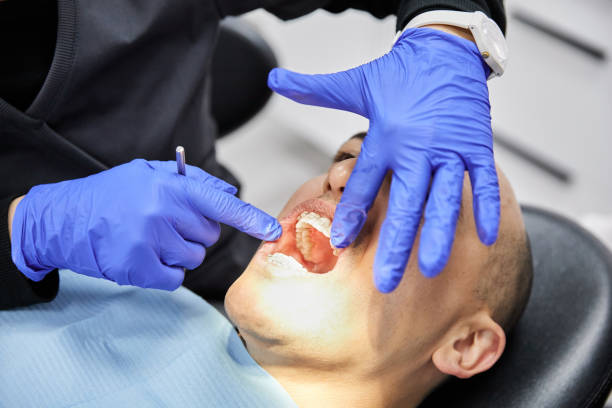 Best Cracked Tooth Emergency Dentist  in Orange, OH