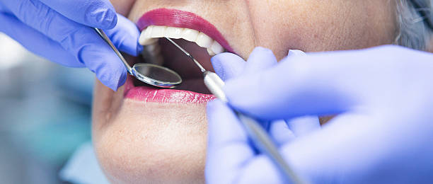 Best Broken Tooth Emergency  in Orange, OH